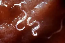 hookworm-larvae.webp